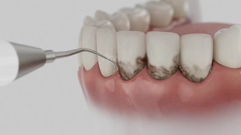 Trusted Dental Implants service in Alexander, AR - Dentist Open Now